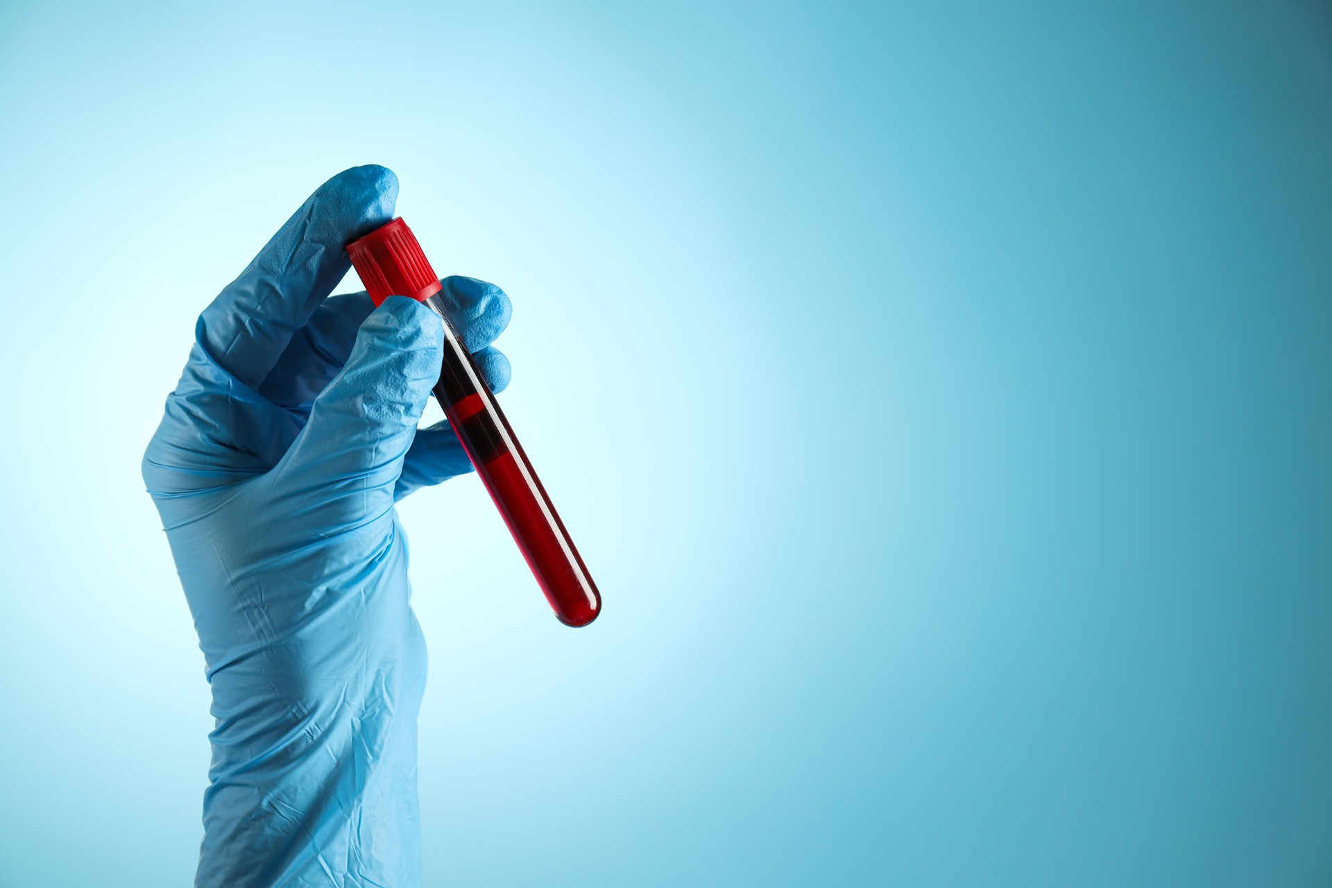 Test tube with donor blood in doctor's hand on blue background, space for text